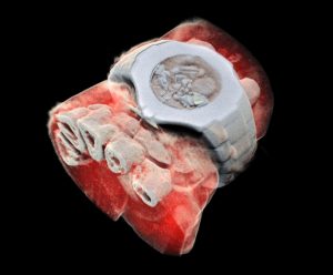 These 3D X-rays are spectacular and really gross